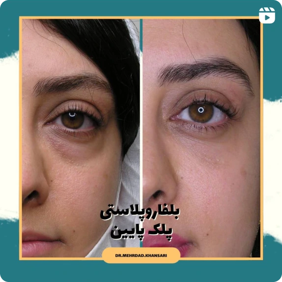 دکتر مهرداد خوانساری جراح پلک