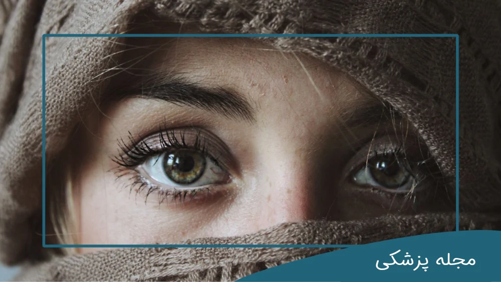 جراحی زیبایی چشم-dr-mkhansari.com