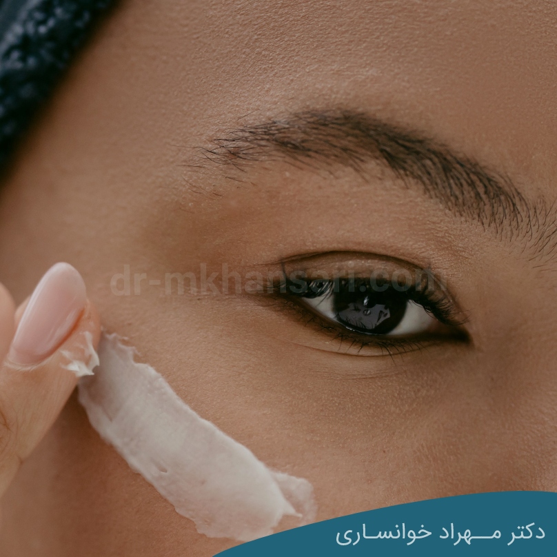 ways to treat puffy eyes-dr-mkhansari