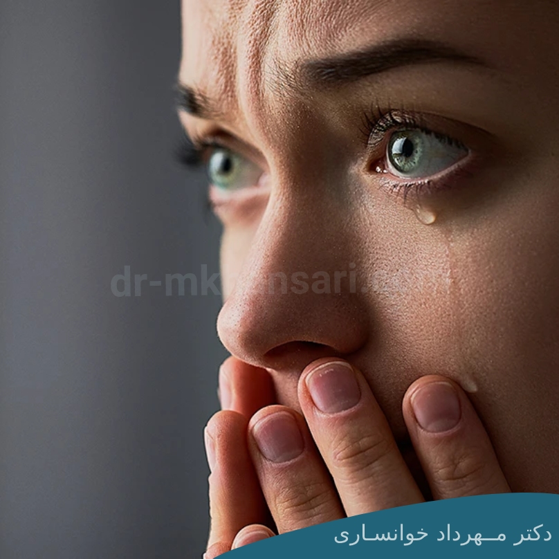 از بین بردن پف چشم بعد از گریه-dr-mkhansari