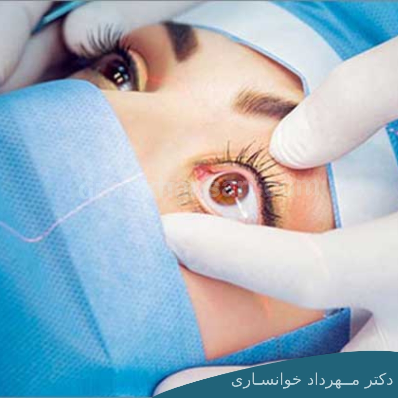 عمل چشم چند نوع است؟-dr-mkhansari