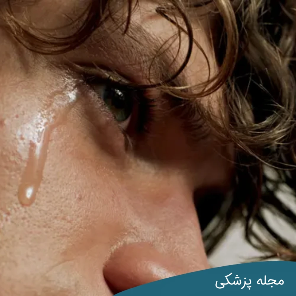 علت ریزش اشک چشم dr-mkhansari