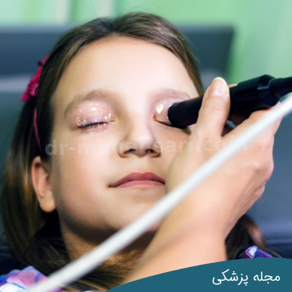 سونوگرافی چشم - dr-mkhansari.com