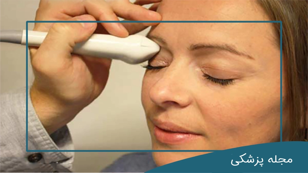 سونوگرافی چشم - dr-mkhansari.com
