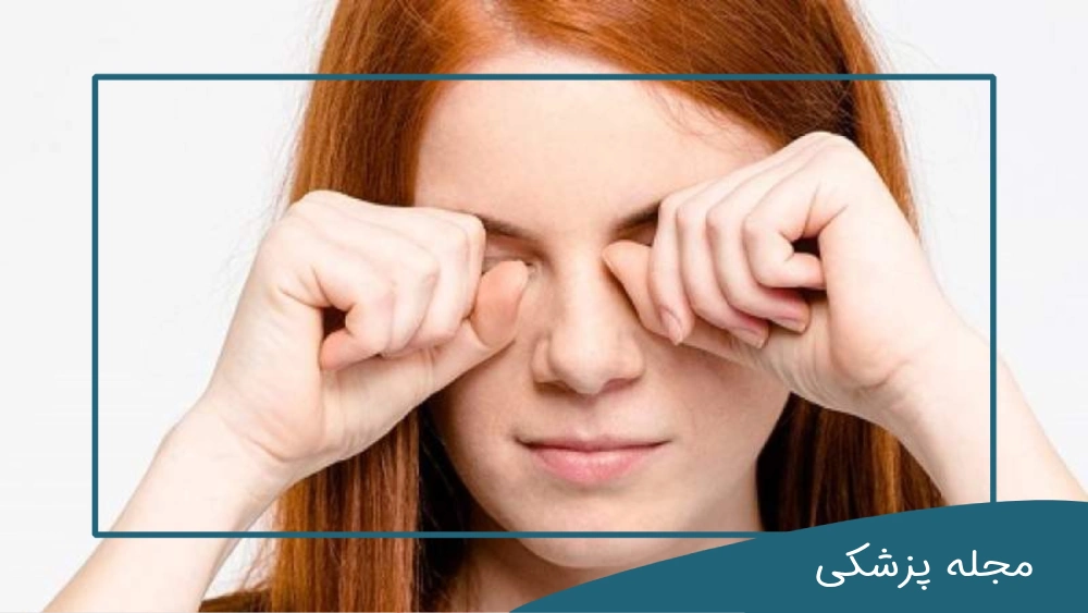 تاثیر آلودگی هوا بر روی چشم - dr-mkhansari.com