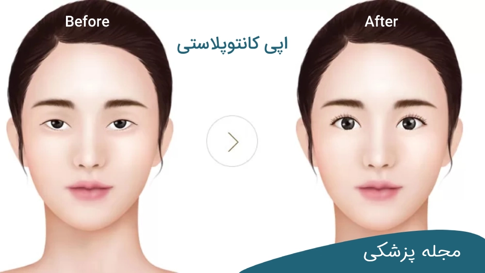 عمل بزرگ كردن چشم - دکتر مهرداد خوانساری