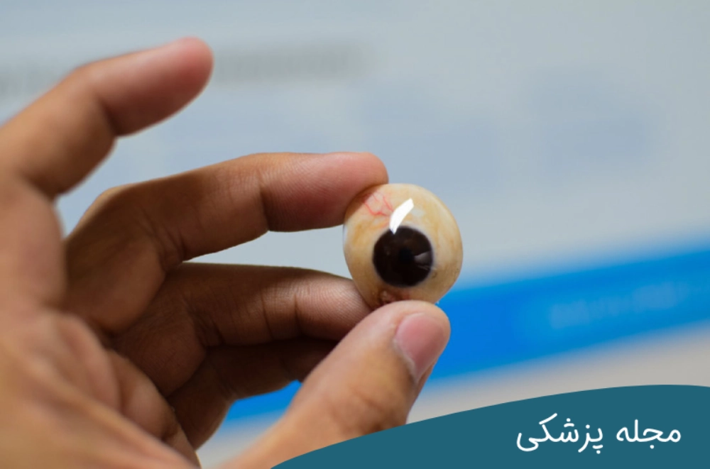 نحوه مراقبت از چشم مصنوعی - دکتر مهرداد خوانساری