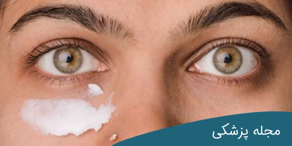 خمیر دندان برای پف زیر چشم - دکتر مهرداد خوانساری