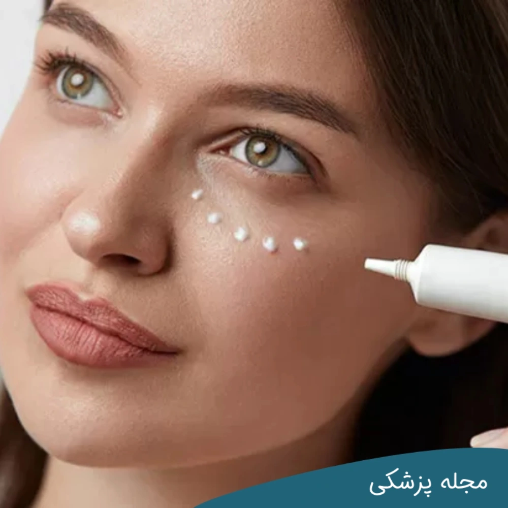 بهترین کرم های دور چشم - دکتر خوانساری