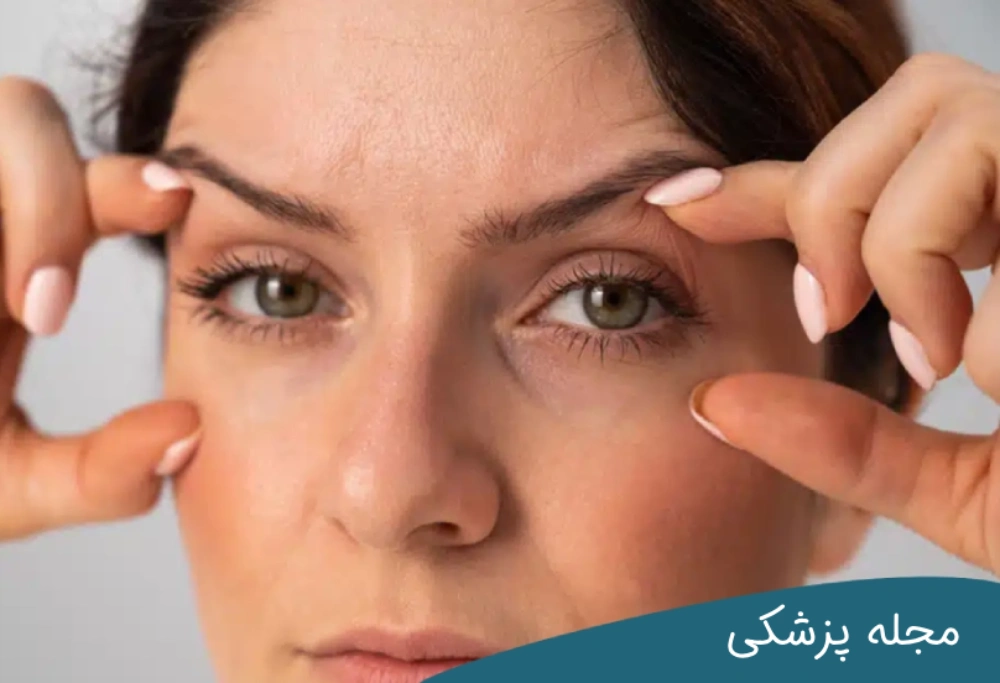 چه سنی برای عمل بلفاروپلاستی مناسب است؟ مجله پزشکی خوانساری