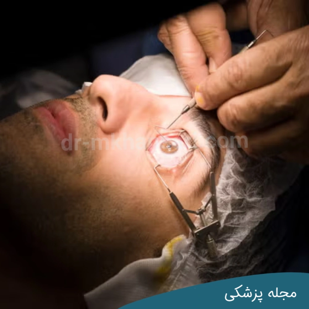 محدوده سنی مطلوب برای جراحی لیزیک - مجله پزشکی خوانساری