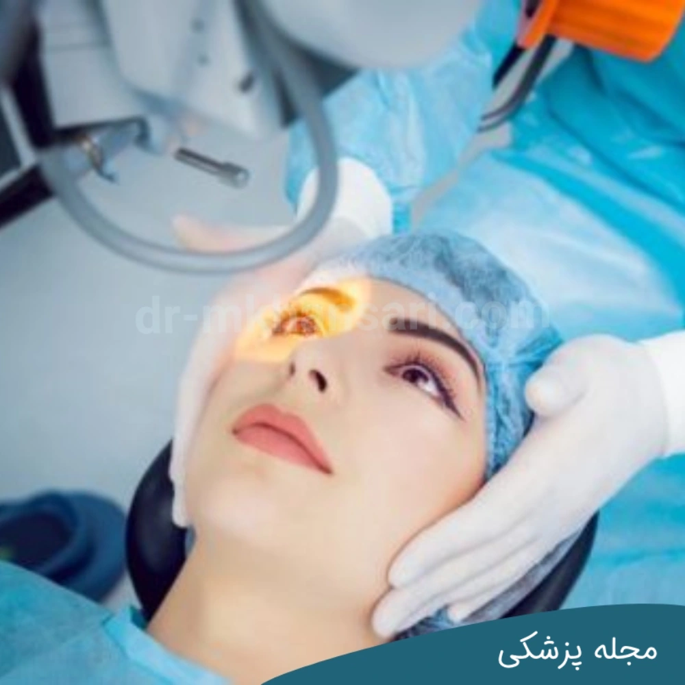 عوامل تاثیرگذار روی تعیین هزینه عمل چشم با بیمه - مجله چشم پزشکی خوانساری