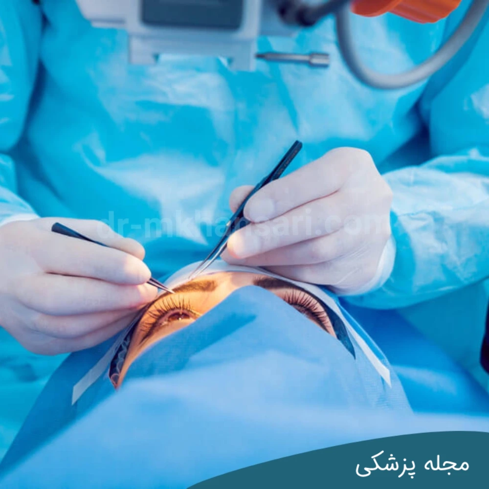 شرایط پوشش عمل‌های بینایی توسط بیمه - مجله چشم پزشکی خوانساری