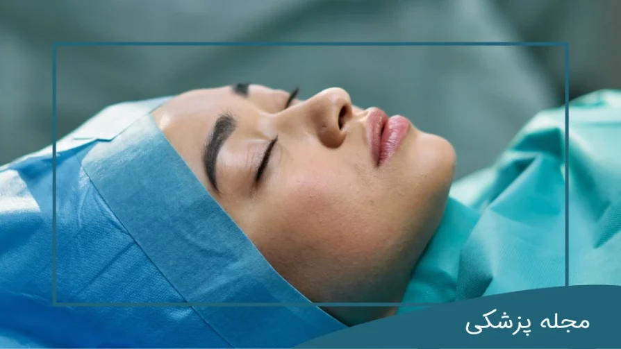 مراقبت های بعد از عمل بلفاروپلاستی-dr-mkhansari.com
