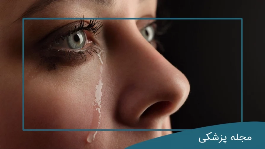 علت ریزش اشک چشم dr-mkhansari