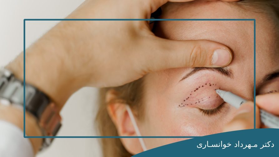 عمل پف بالای چشم-dr-mkhansari