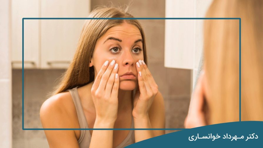 علت پف پشت چشم در صبح - dr-mkhansari