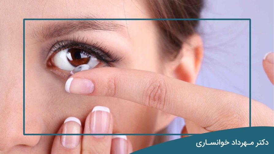 لنز تماسی - dr-mkhansari