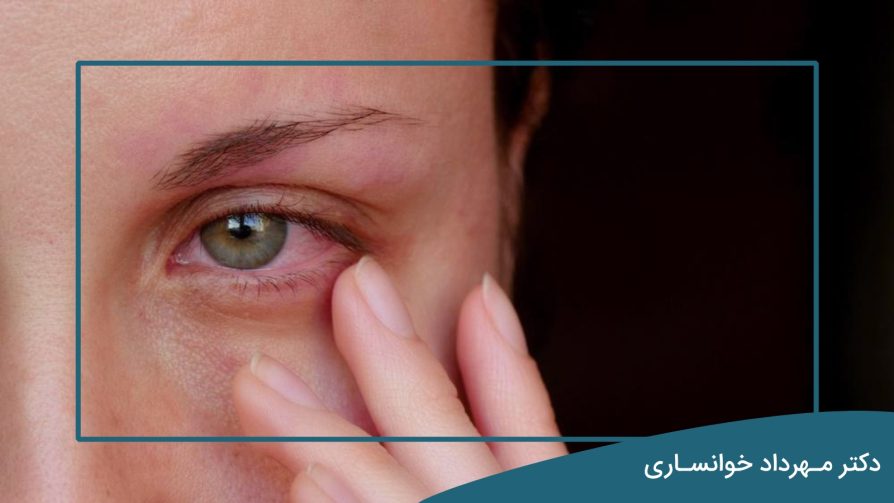 خطرات قرمزی چشم - dr-mkhansari