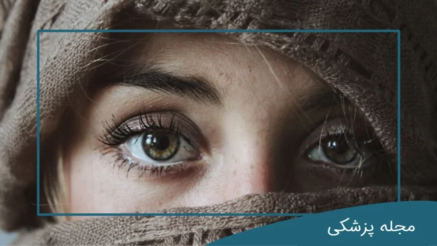 جراحی زیبایی چشم-dr-mkhansari.com