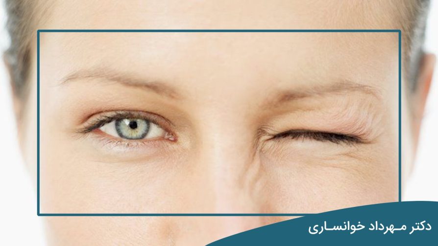 پرش پلک - دکتر مهرداد خوانساری