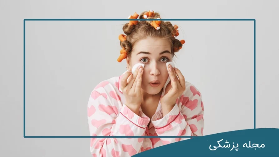 از بین بردن پف چشم بعد از گریه-dr-mkhansari
